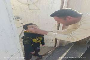 واکسناسیون فلج اطفال